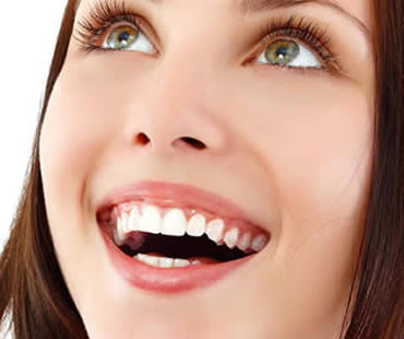 Who Could Benefit from Dental Veneers?